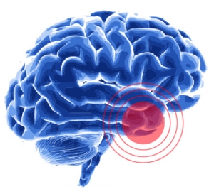 brain tumors micronutrients 