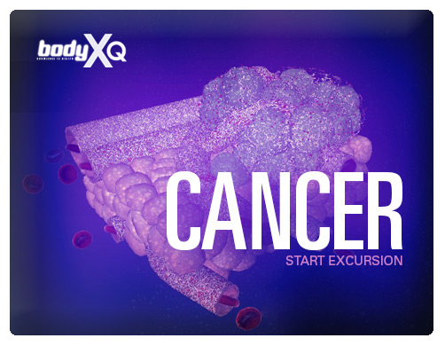 Body Xq Cancer