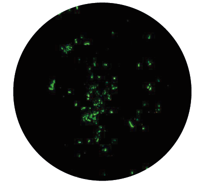 latent form borrelia