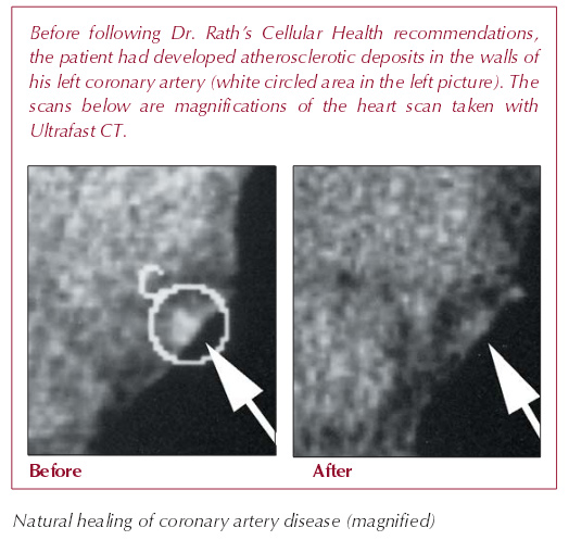 heart disease clinical study dr rath