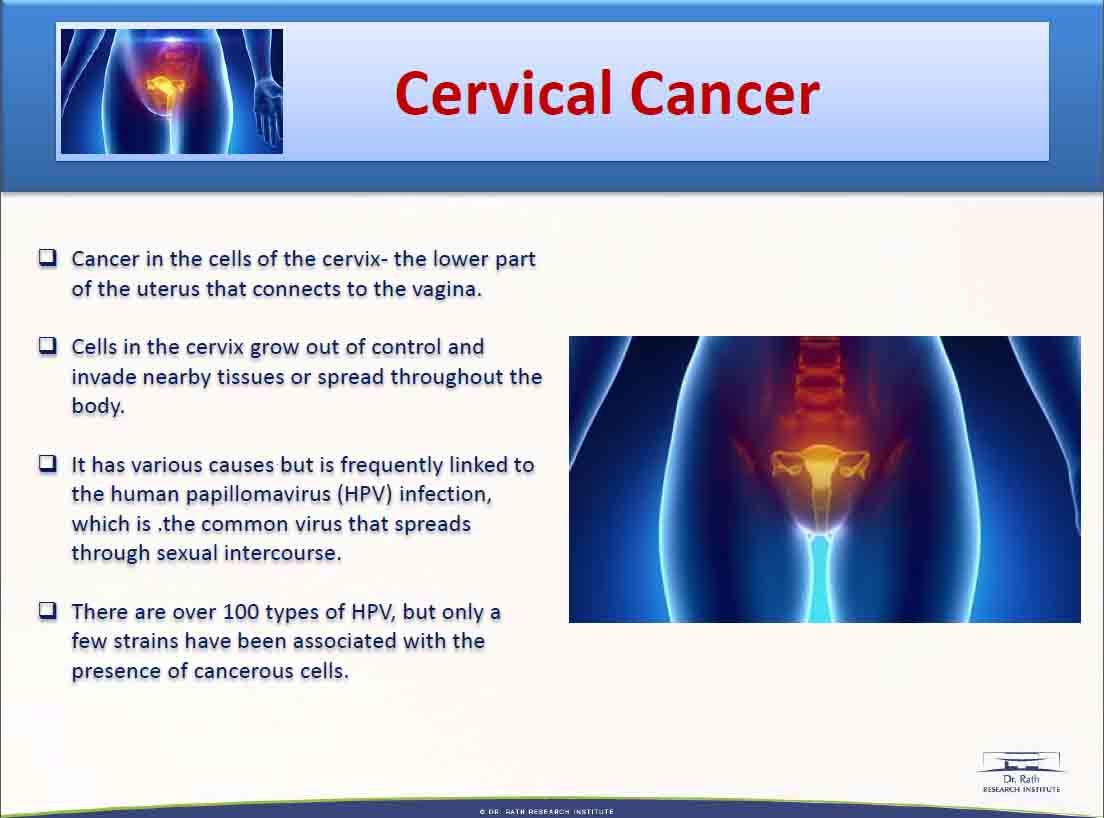 cervial cancer