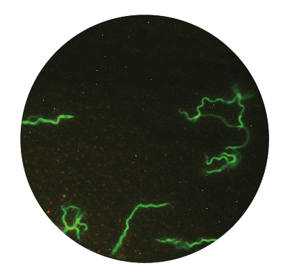 spirochetes