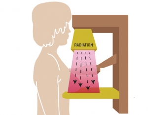 radiation breast cancer micronutrients 