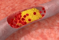 cholesterol micronutrients 