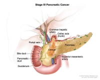 pancreatic cancer micronutrients