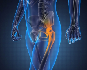 bone cancer micronutrients 