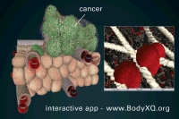 breast cancer micronutrients 