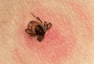 New Findings In Lyme Disease Research