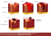 The Benefits Of Micronutrients In Wound Healing