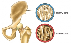 micronutrients vs bones connective tissue 