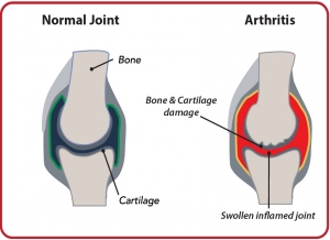 Joints micronutrients 