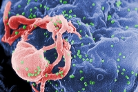JAMA Study Confirms: Micronutrients Can Help Prevent the Development of AIDS in HIV-Infected People